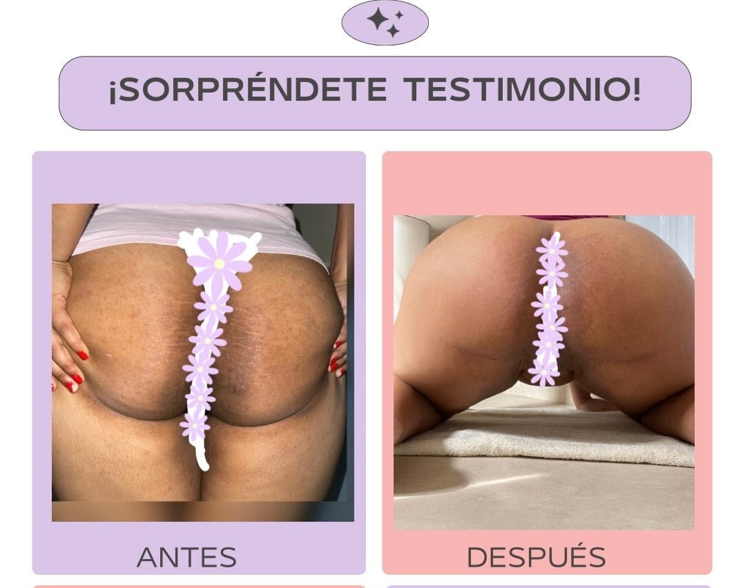 Kit Blanqueador