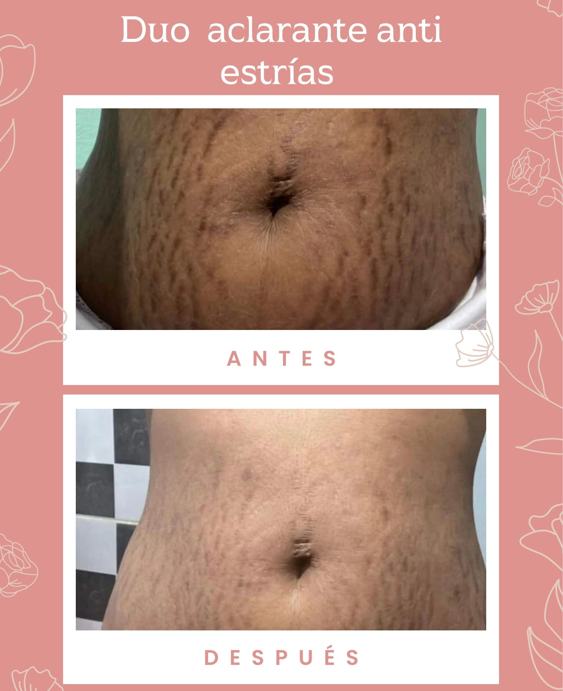 Crema blanqueadora + Aceite aclarante